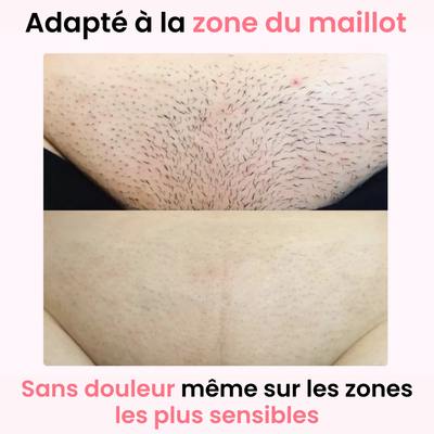 Depilator Laserowy IPL - Ulvessa Pro